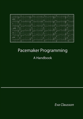 Pacemaker Programming (e-bok) av Eva Clausson