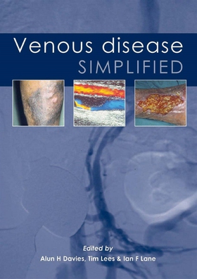 Venous Disease Simplified (e-bok) av 