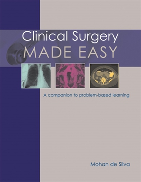 Clinical Surgery Made Easy (e-bok) av Mohan de 