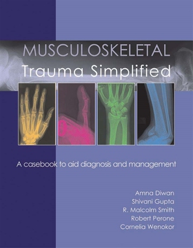 Musculoskeletal Trauma Simplified (e-bok) av Am