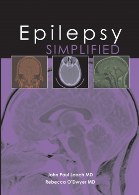 Epilepsy Simplified (e-bok) av Rebecca O'Dwyer,