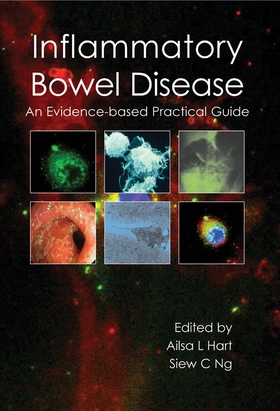 Inflammatory Bowel Disease (e-bok) av 