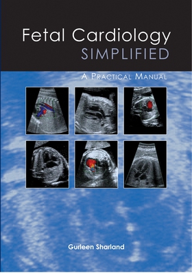 Fetal Cardiology Simplified (e-bok) av Gurleen 