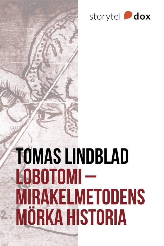 Lobotomi - Mirakelmetodens mörka historia