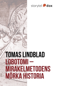 Lobotomi - Mirakelmetodens mörka historia (e-bo