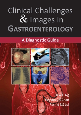 Clinical Challenges & Images in Gastroenterolog