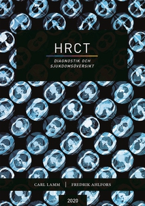 HRCT - diagnostik och sjukdomsöversikt (e-bok)
