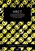 HRCT - pattern recognition and differential diagnosis of lung disease