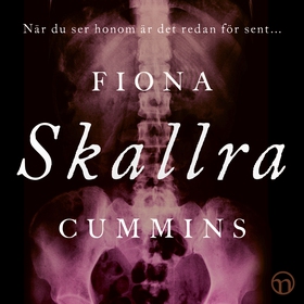Skallra (ljudbok) av Fiona Cummins