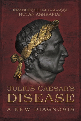 Julius Caesar's Disease (e-bok) av Francesco Ma