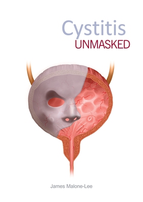 Cystitis unmasked (e-bok) av James Malone-Lee