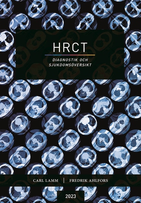 HRCT – diagnostik och sjukdomsöversikt (e-bok) 