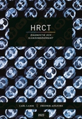 HRCT – diagnostik och sjukdomsöversikt