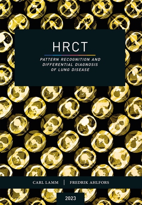 HRCT – Pattern Recognition and Differential Dia