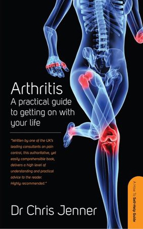 Arthritis - A Practical Guide to Getting on With Your Life (ebok) av Chris Jenner