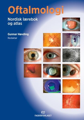 Oftalmologi - nordisk lærebok og atlas (ebok) av -