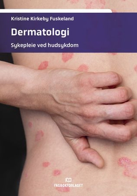 Dermatologi - sykepleie ved hudsykdom (ebok) av Kristine Kirkeby Fuskeland